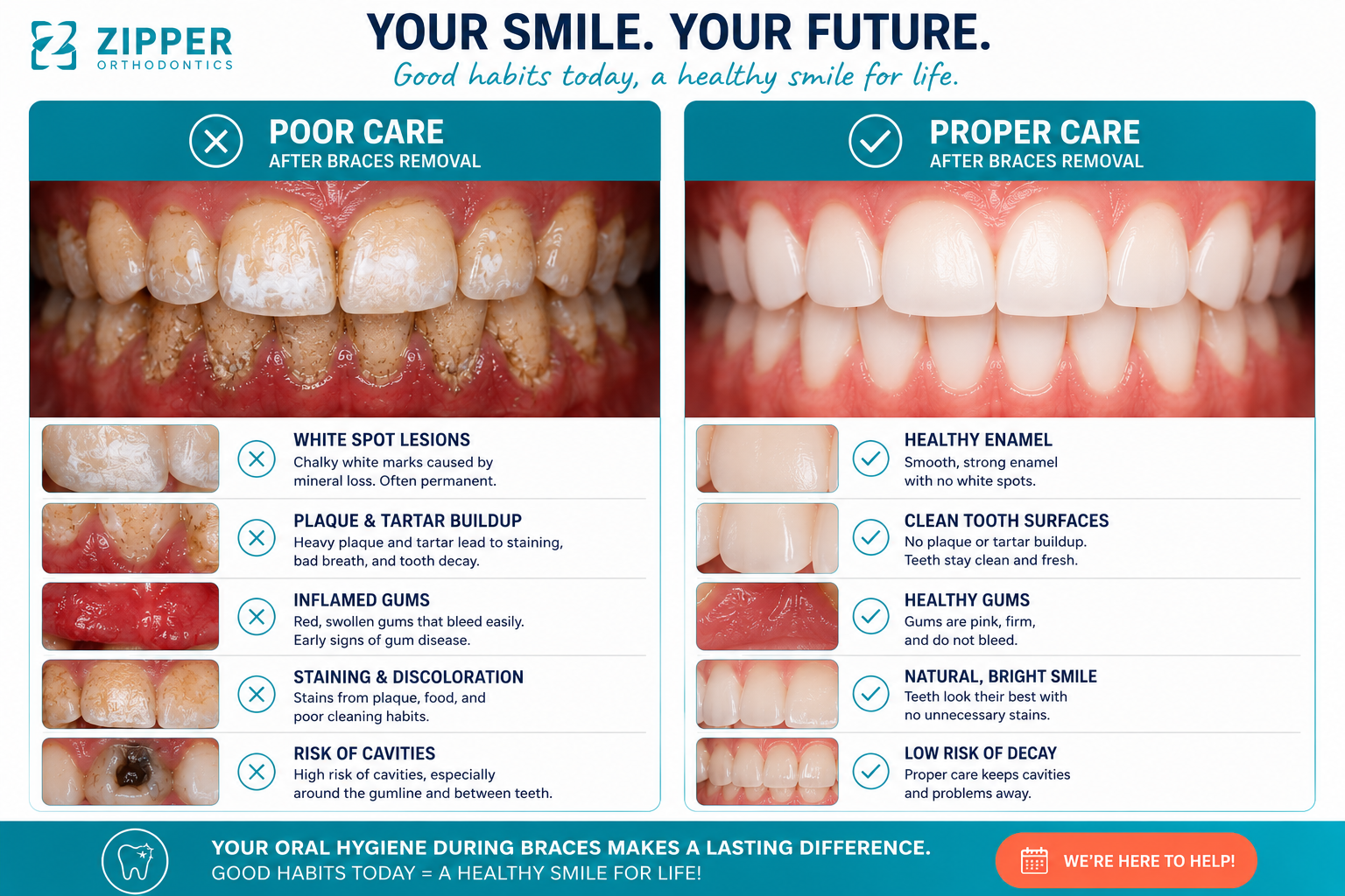 Comparison of poor care vs proper care after braces removal — showing white spot lesions, plaque buildup, and inflamed gums on the left versus healthy enamel, clean surfaces, and bright smile on the right
