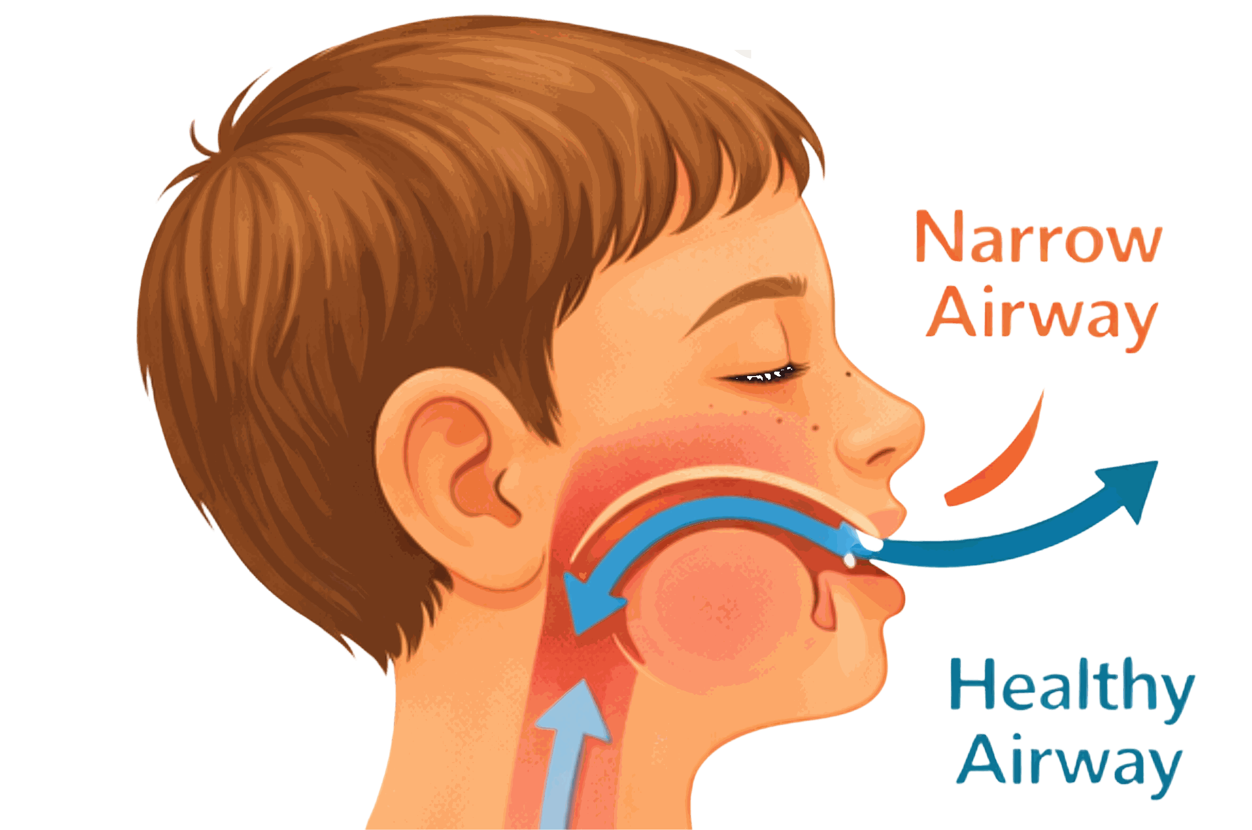Airway Orthodontics