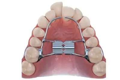 Expanders